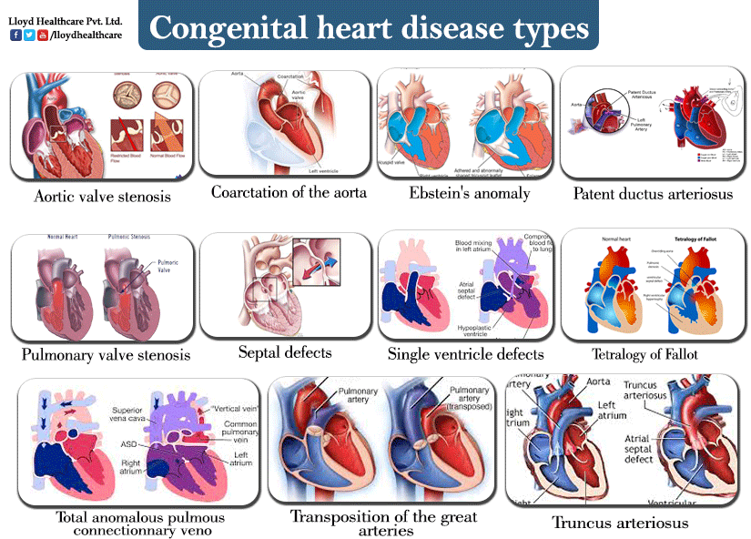 presentation on congenital heart diseases